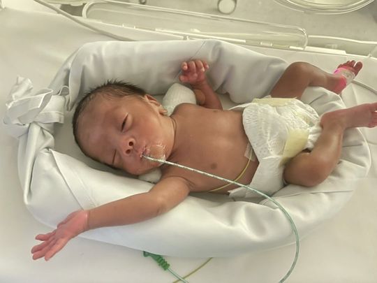 United Arab Emirates: Timely intervention saves premature baby's vision